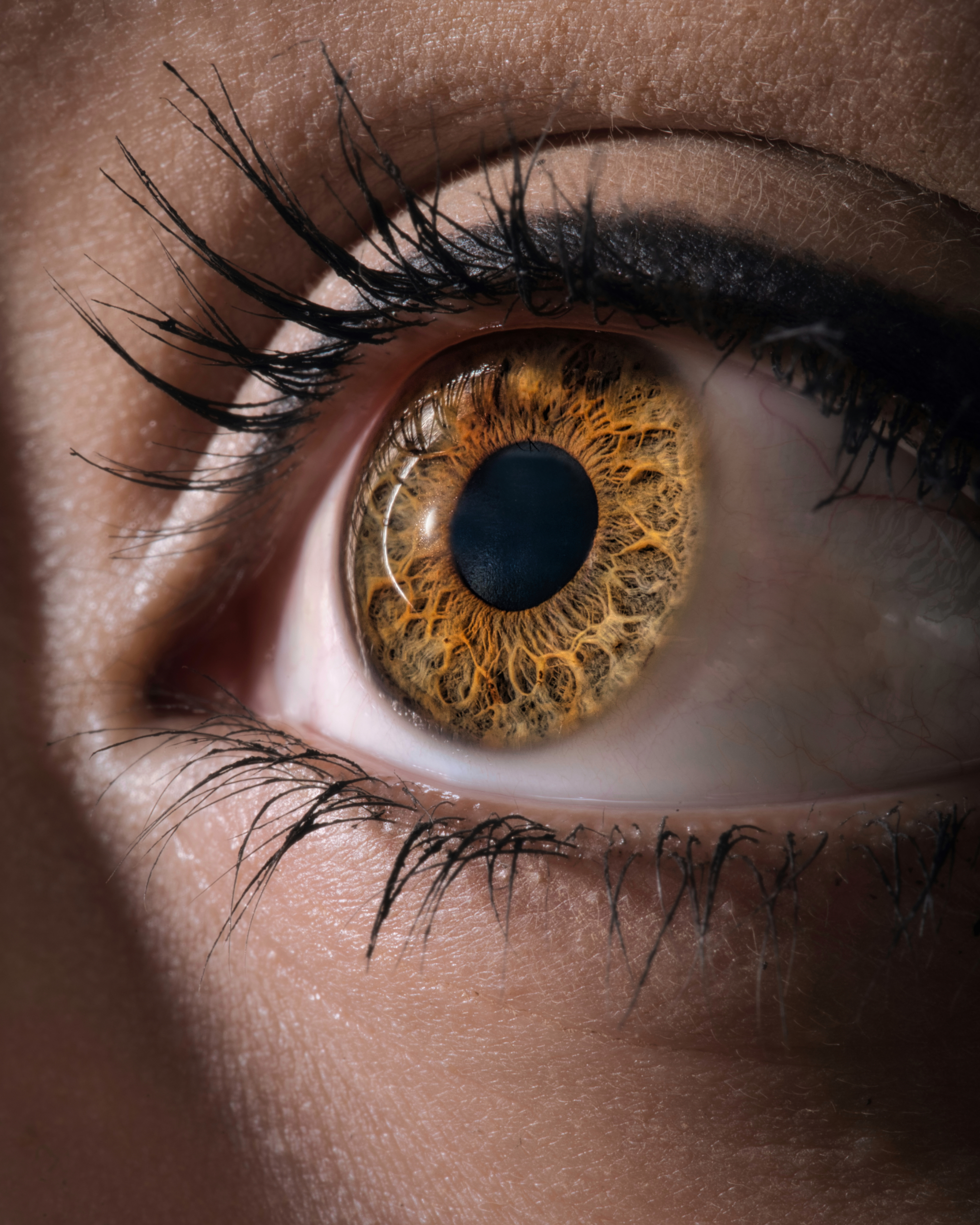 Close-up of an eye showing the cornea, restored through DSAEK corneal transplant surgery at The Eye Doctor Clinic