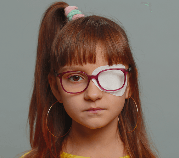 Amblyopia (lazy eye) treatment