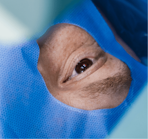 Implantable collamer lens (ICL) implantation