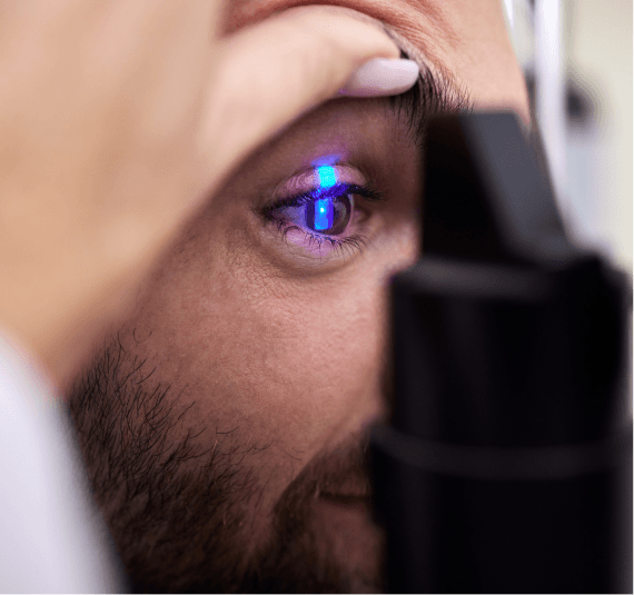 LASIK and LASEK laser eye surgery