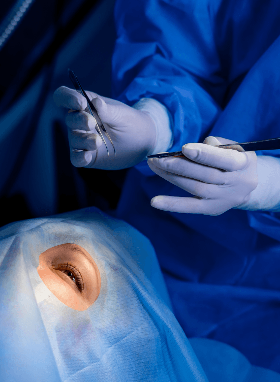 Lens replacement surgery
