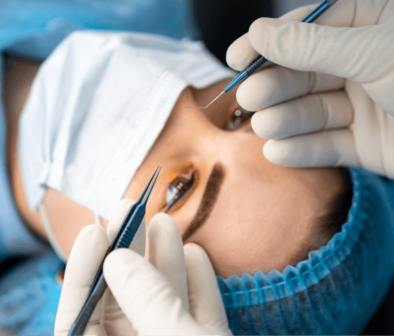 Punctoplasty tear duct surgery