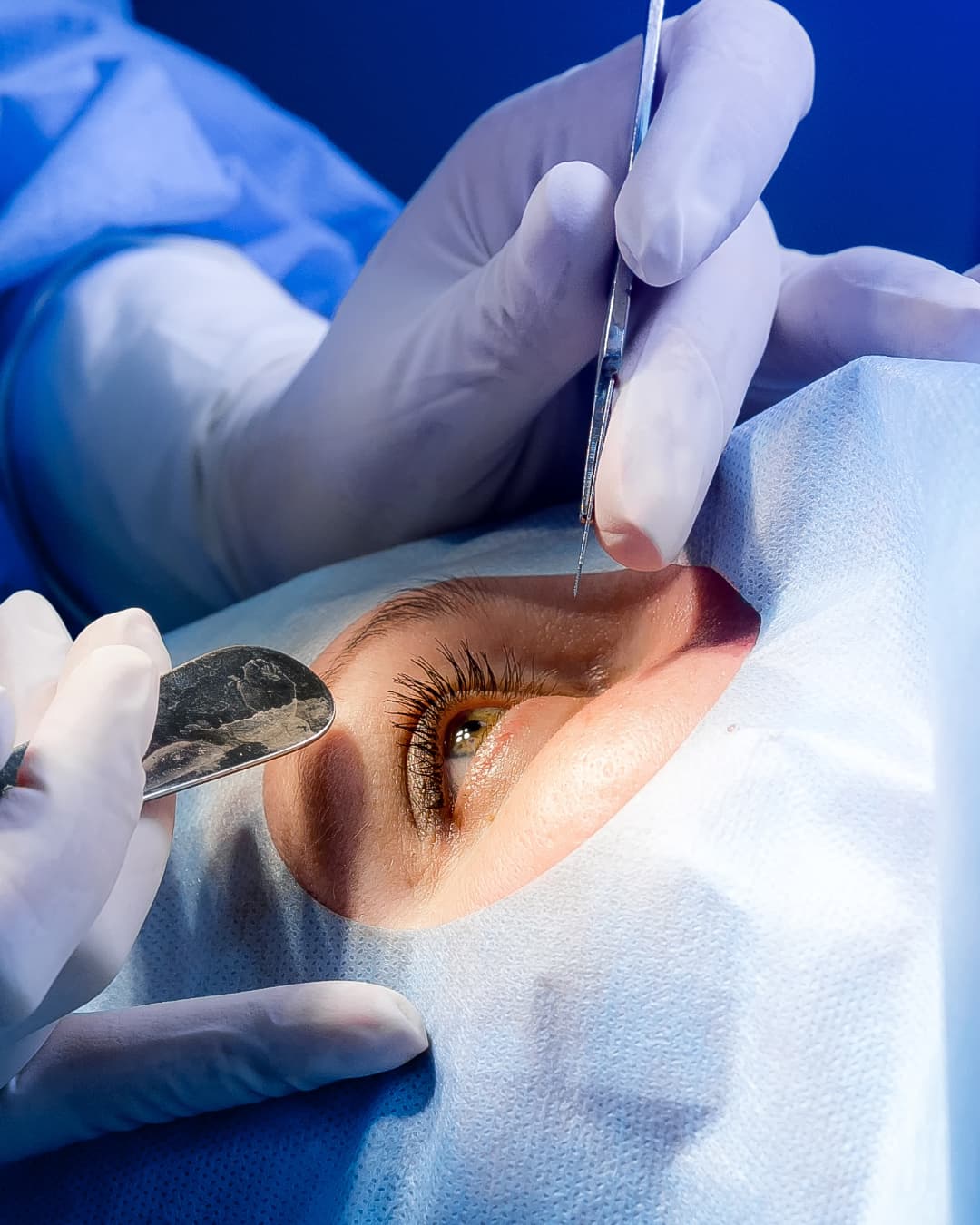 Vitreoretinal surgery at The Eye Doctor, Huddersfield