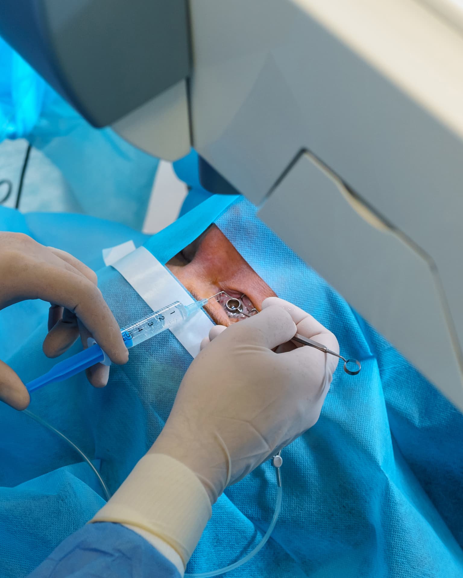 Consultant-led trabeculectomy glaucoma surgery at The Eye Doctor in Huddersfield