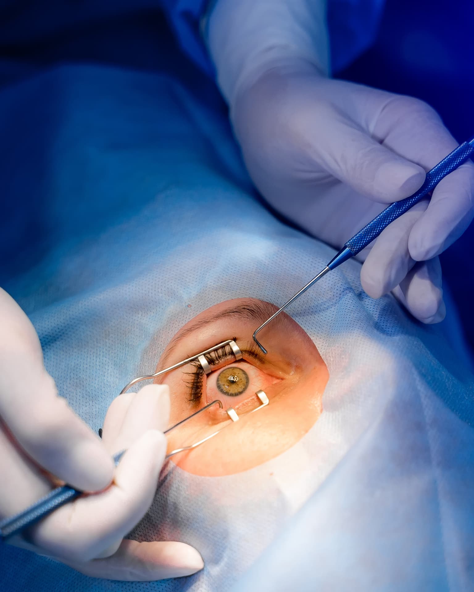 Consultant-led glaucoma tube surgery at The Eye Doctor in Huddersfield