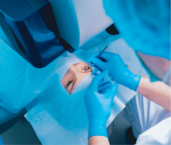 DSAEK partial thickness corneal transplant