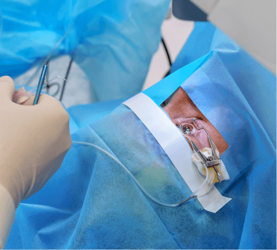Trabeculectomy glaucoma drainage surgery