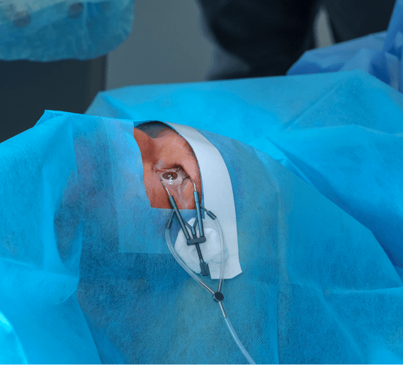 Glaucoma tube implant (shunt) surgery